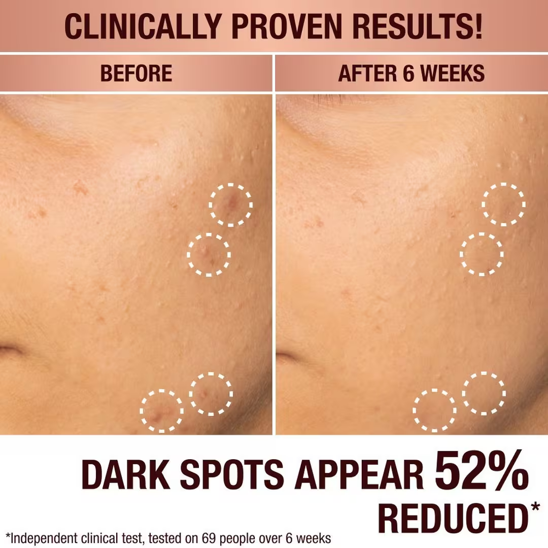 Dark Spot Correcting Radiance Recovery Serum