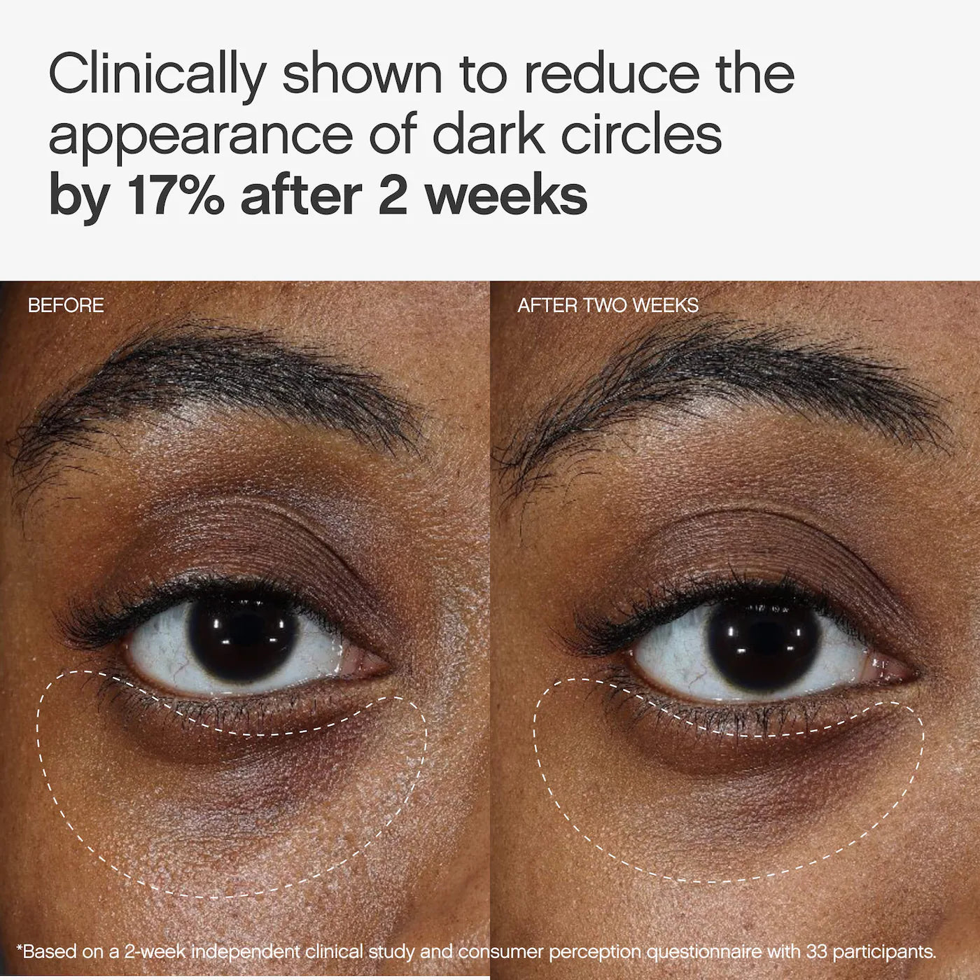 Faded Under Eye Brightening & Clearing Eye Masks Preventa