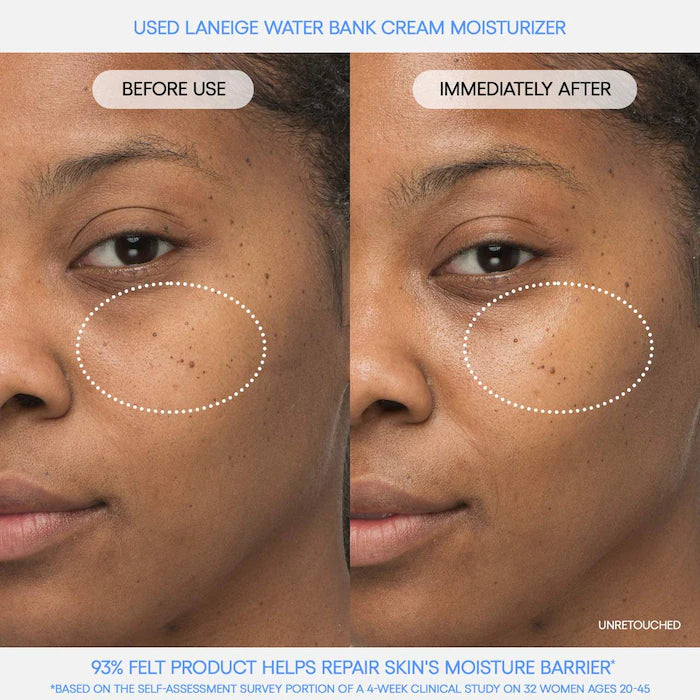 Water Bank Blue Hyaluronic Hydration Set - PREVENTA