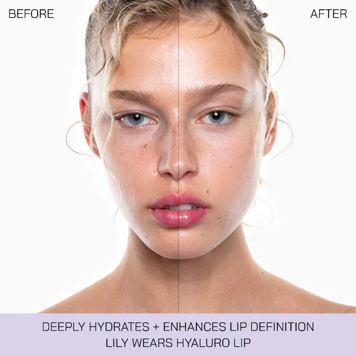 Hyalurolip Lip Plumper with Hyaluronic Acid - PREVENTA