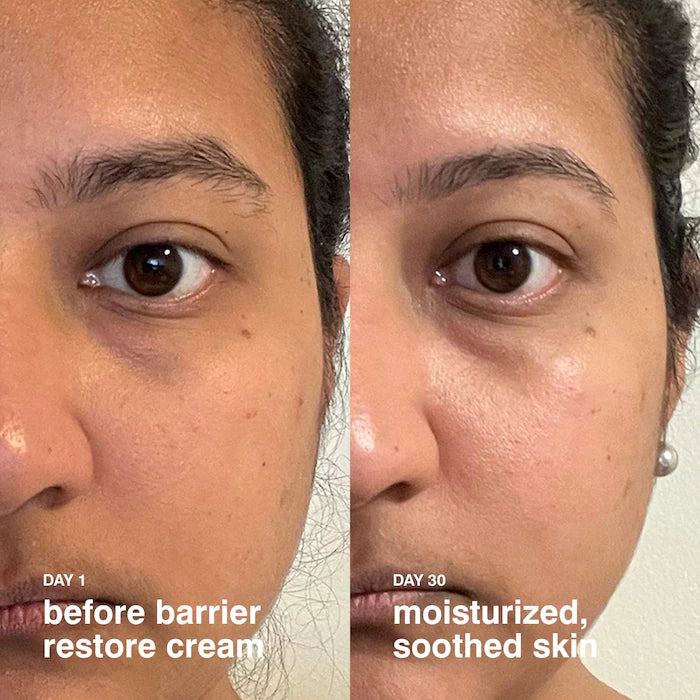 Barrier Restore Cream