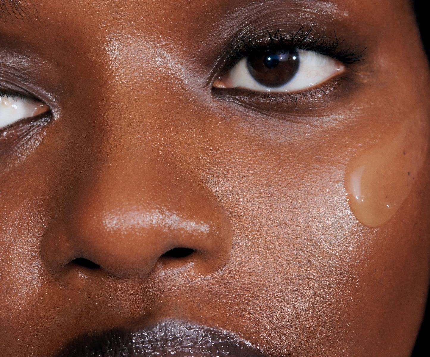 The Spot Care Set - PREVENTA